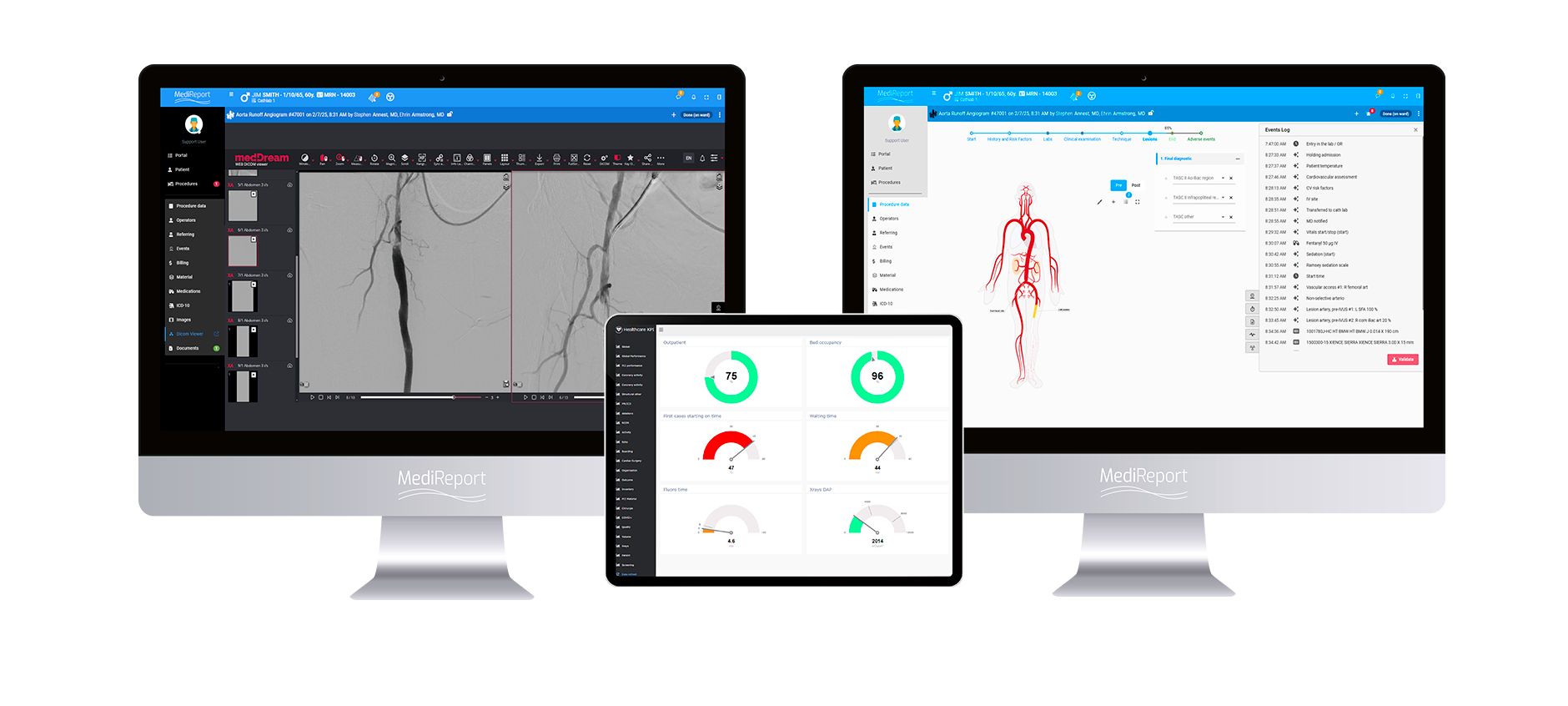 MediReport 360 vascular mock up